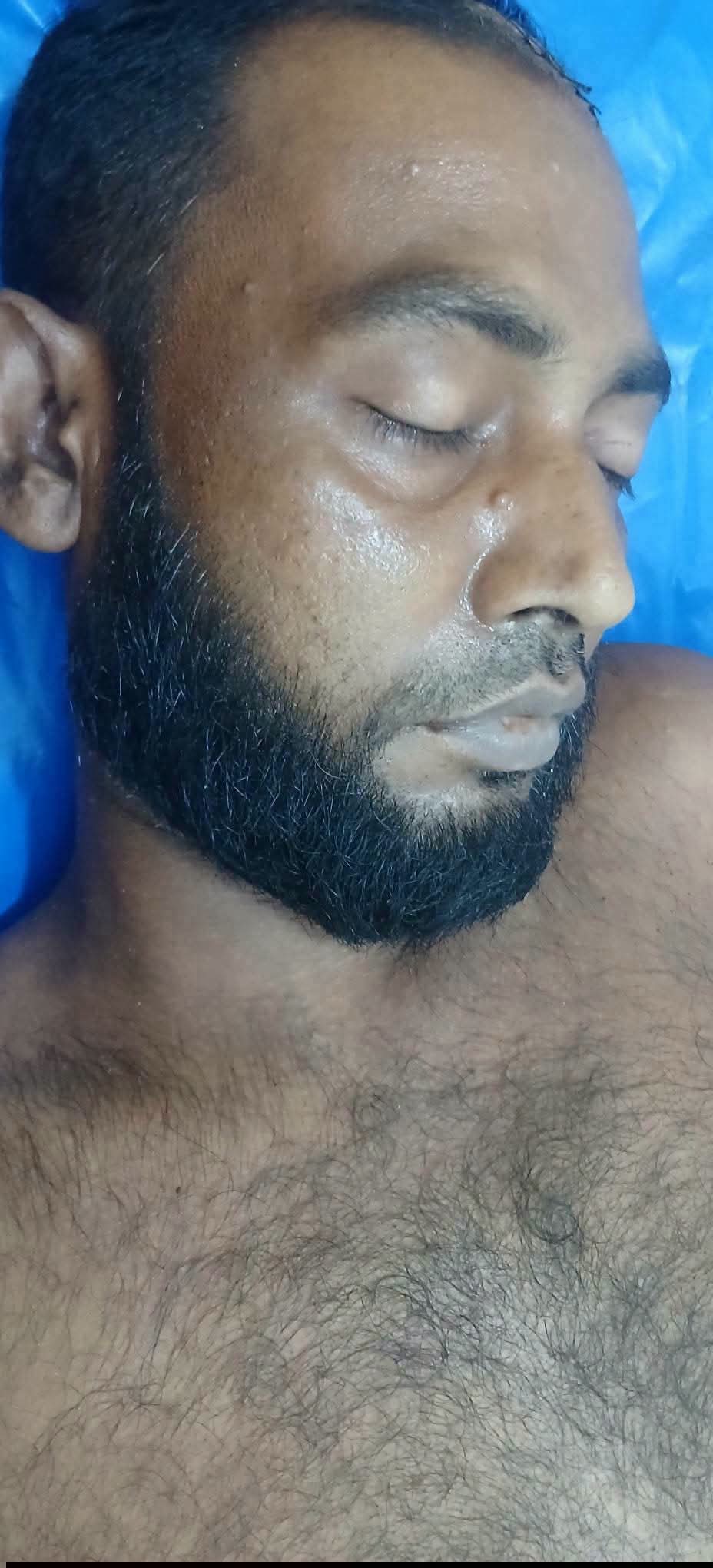 শ্রীমঙ্গলে চায়ের স্টলে হামলায় আহত রাজমিস্ত্রির মৃত্যু, অভিযুক্ত গ্রেপ্তার
