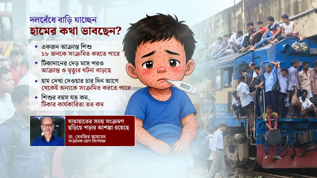 ঈদকে ঘিরে বাড়তে পারে হামের সংক্রমণ, কোনো নির্দেশনা নেই সরকারের