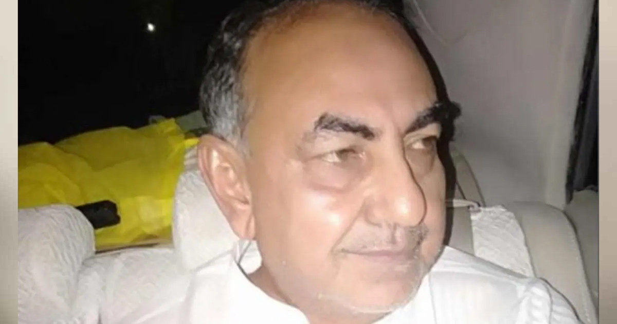 সিঙ্গাপুরে মির্জা আব্বাসের শারীরিক অবস্থার উন্নতি