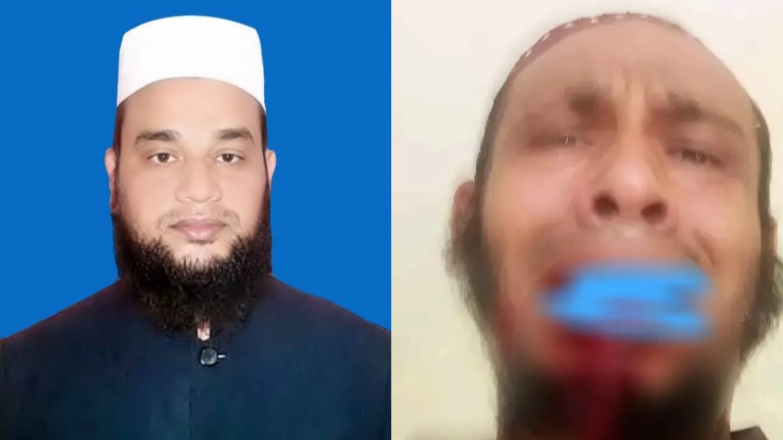 ঘুষি মেরে কম্পিউটার অপারেটরের দাঁত ভেঙে দিলেন অধ্যক্ষ