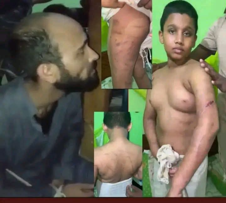 জকিগঞ্জের কথিত জীন মোল্লার হাতে ১৬ পারার কোরআনে হাফেজ তাসকিন অমানবিক নির্যাতনের শিকার