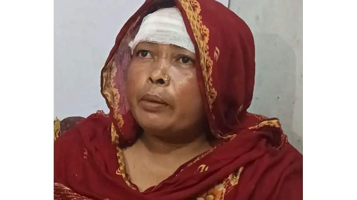 গাইবান্ধায় কিস্তির টাকা না পেয়ে মাথা ফাটালেন এনজিও কর্মী