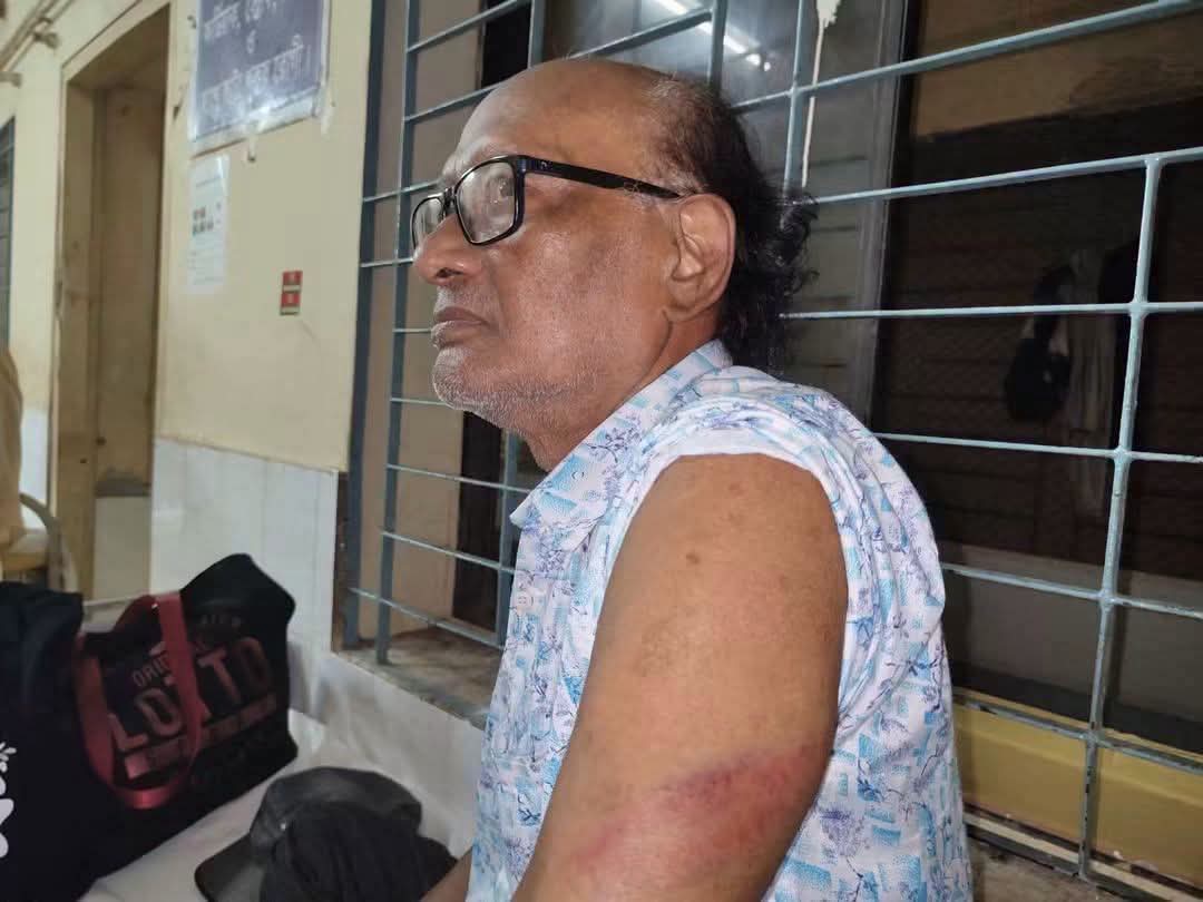 লালমনিরহাট একুশে টিভি’র সাংবাদিকে ওপর হামলা, আটক ১