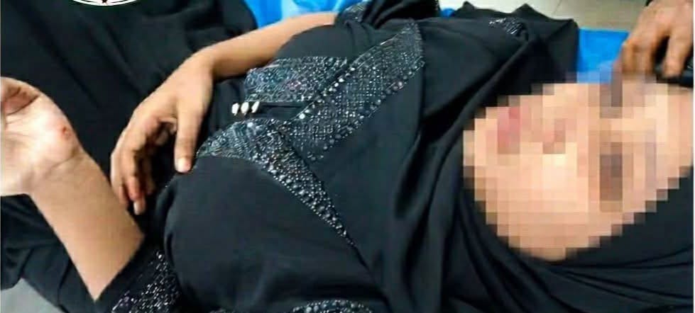 মৌলভীবাজারে উত্ত্যক্তের শিকার হয়ে চলন্ত টমটম থেকে লাফ, কলেজছাত্রীর ২ দাঁত ভাঙল