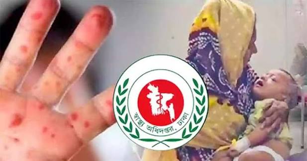 হাম উপসর্গে আরও ৬ জনের মৃত্যু