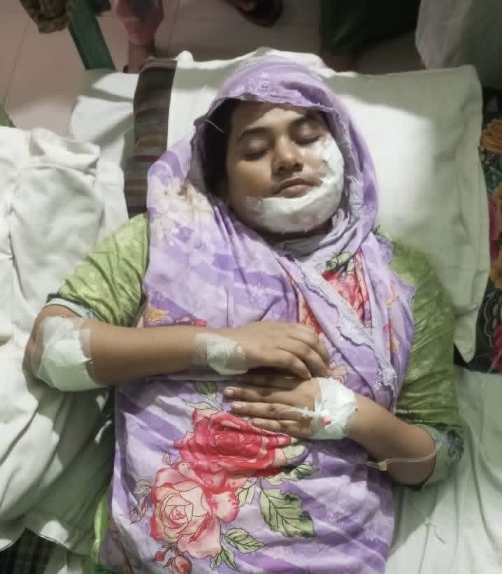 গভীর রাতে ঘরে চোরের হানা, নারীকে কুপিয়ে স্বর্ণালংকার ও নগদ অর্থ লুট