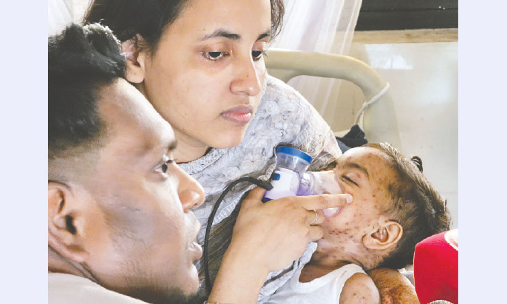 দেশে হামের সংক্রমণ বেড়েছে ৭৫ গুণ