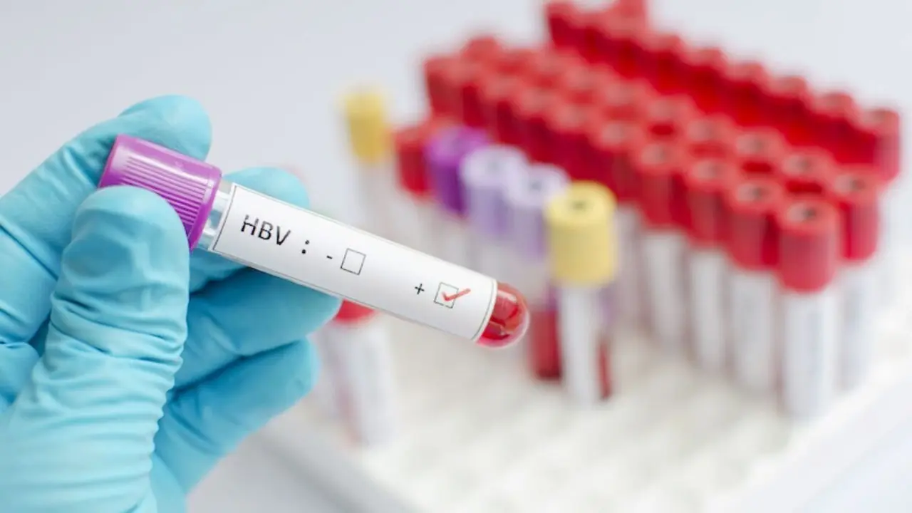 এক বছরে বিশ্বজুড়ে হেপাটাইটিস বি কমেছে ৩২ শতাংশ