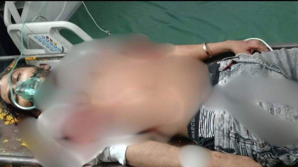 কেন্দ্রীয় শহীদ মিনারে গুলিবিদ্ধ রাকিব মারা গেছেন