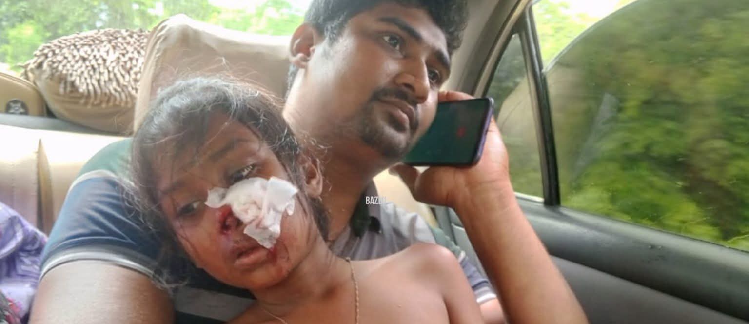 পাইকগাছায় বিদ্যালয়ে ক্লাস চলাকালে ফ্যান খুলে পড়লো শিক্ষার্থীর উপর