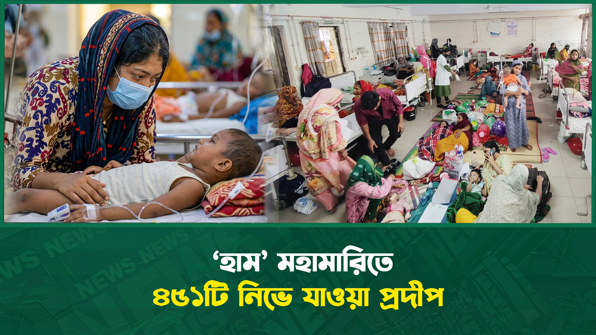 ‘হাম’ মহামারিতে ৪৫১টি নিভে যাওয়া প্রদীপ
