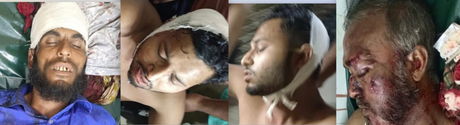 যশোরে বিএনপির দুই গ্রুপের সংঘর্ষে আহত ৩, ককটেল বিস্ফোরণ