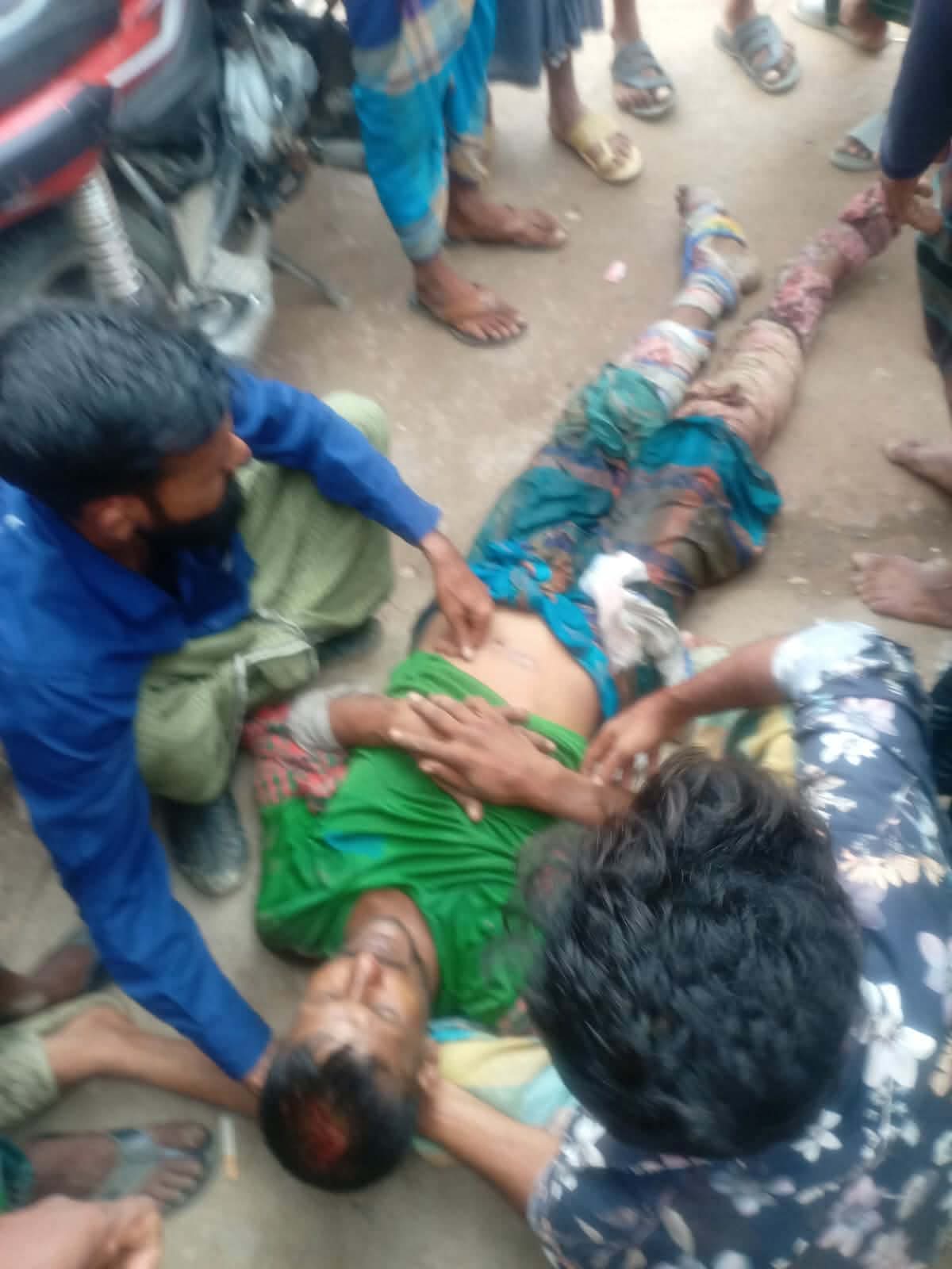 পাওনা টাকা নিতে গিয়ে কুপিয়ে হত্যাচেষ্টা, ইউপি সদস্যসহ ১৫ জনের বিরুদ্ধে অভিযোগ