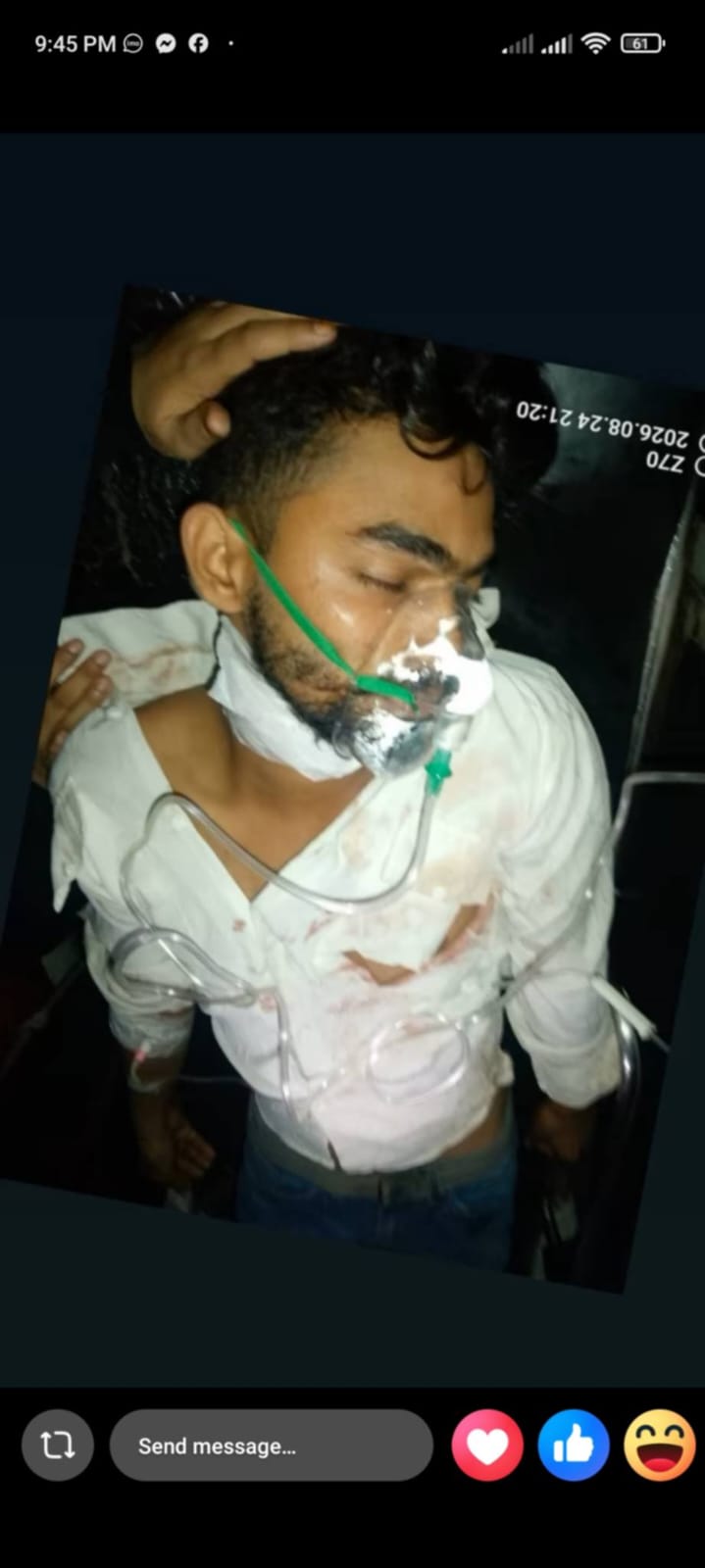 ফেনীর সোনাগাজীতে যুবককে ছুরিকাঘাত করে টাকা ছিনতাই, আটক ২