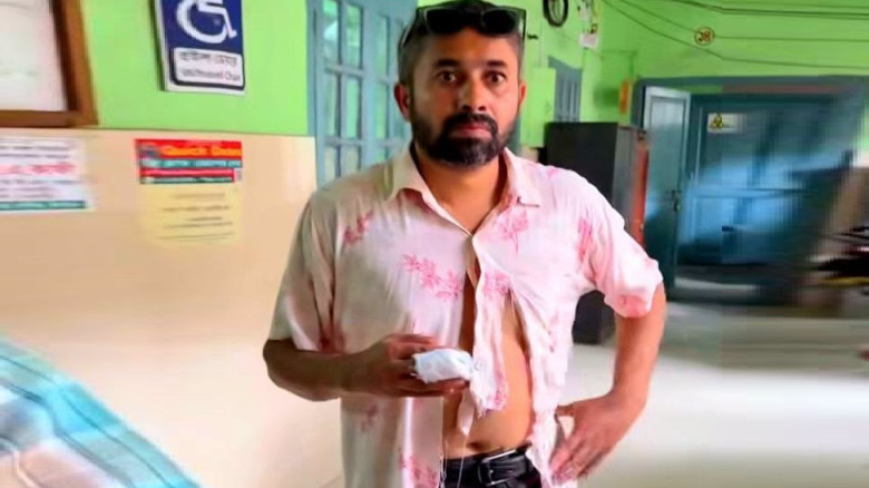 ঝিনাইদহে পাগলা কুকুরের হামলায় আহত ৬